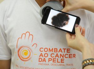 mutirao-atende-populacao-hoje,-no-dia-de-combate-ao-cancer-de-pele